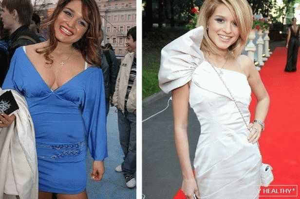 Бородина до и после похудения